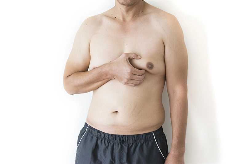 MALE Chest Reduction in Miami