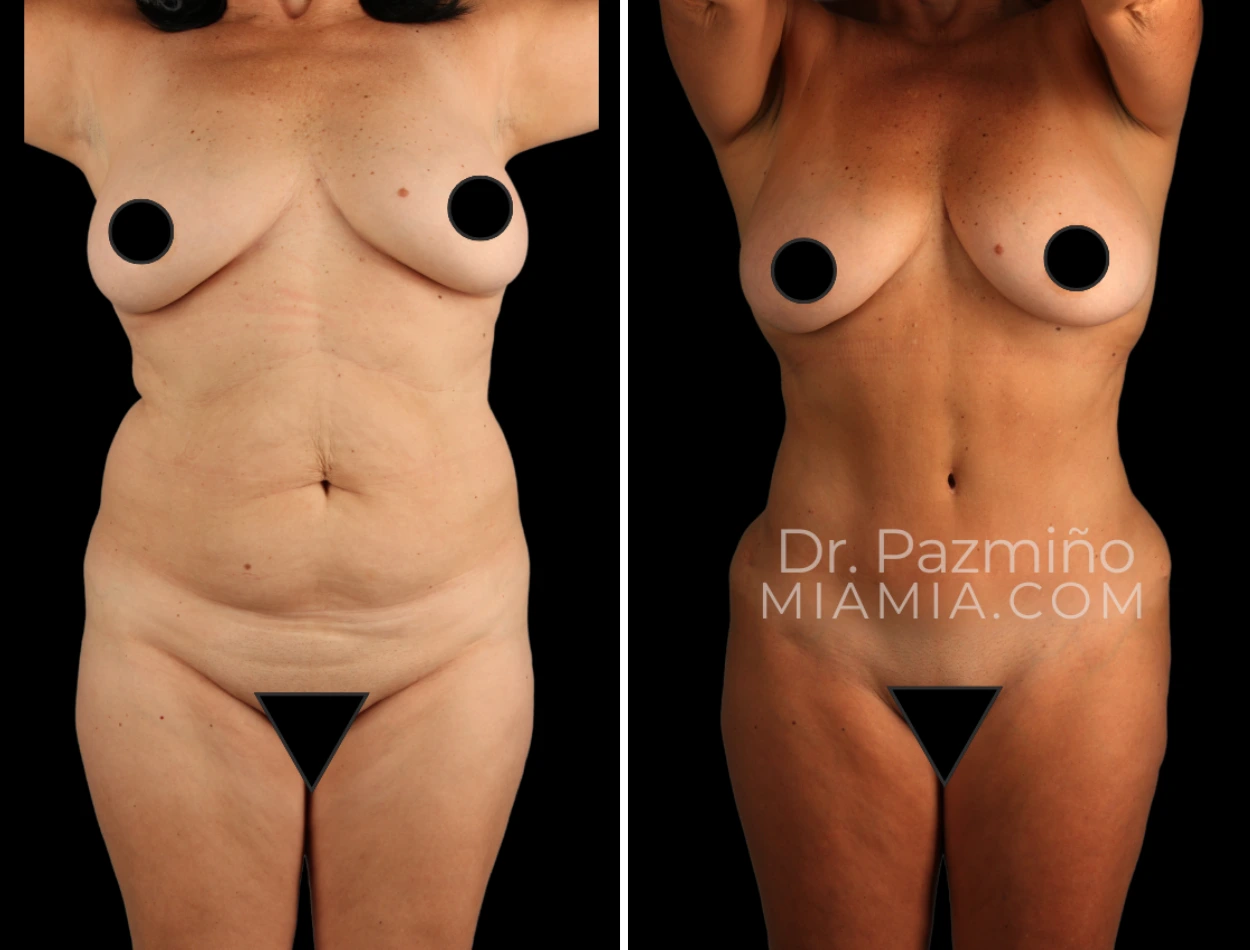 miamiaes (32)