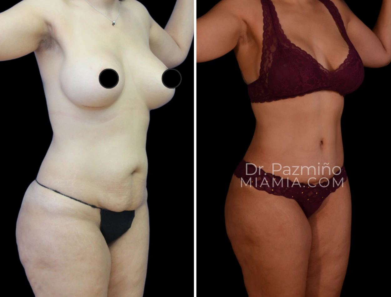 miamiaes (56)