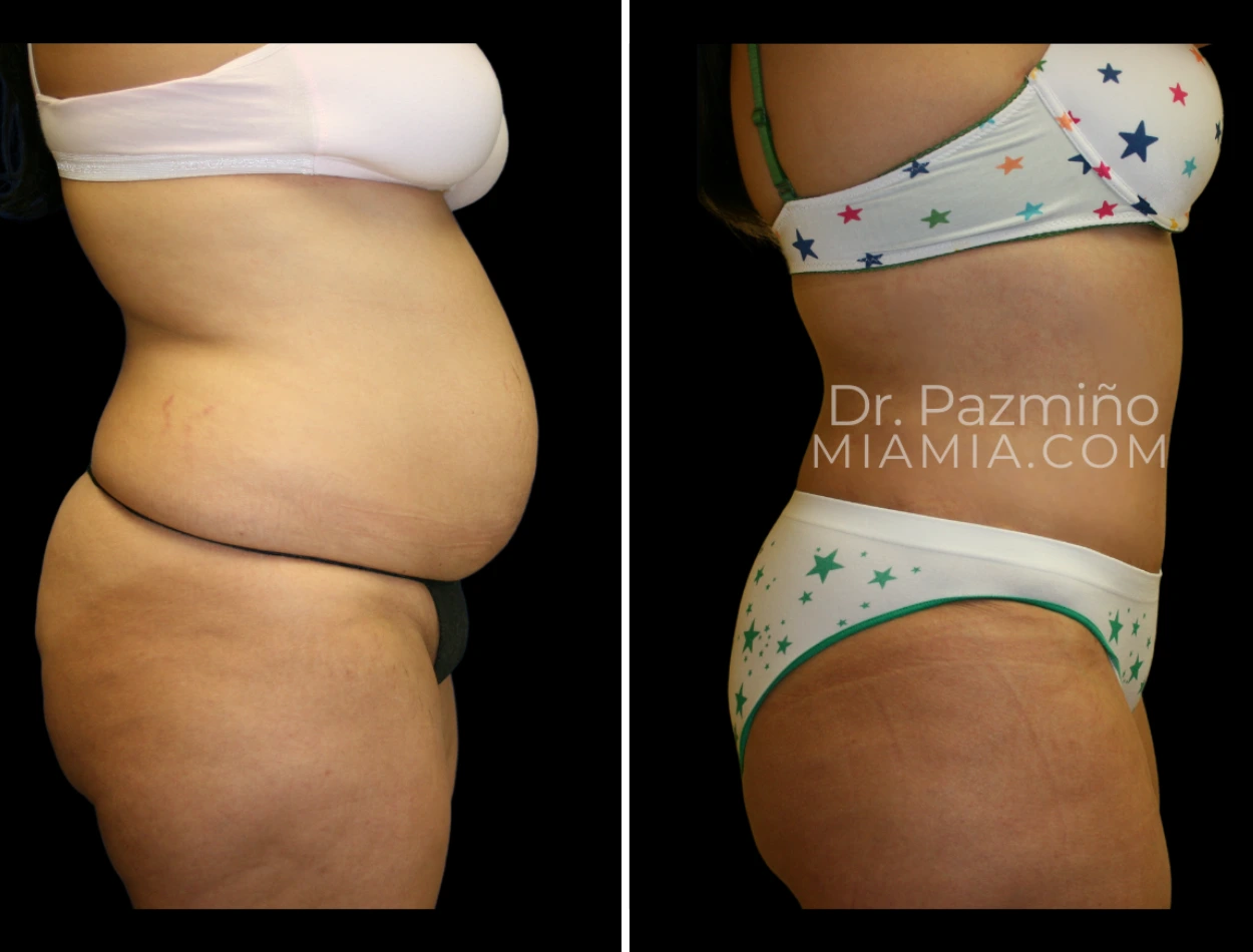 miamiaes (77)