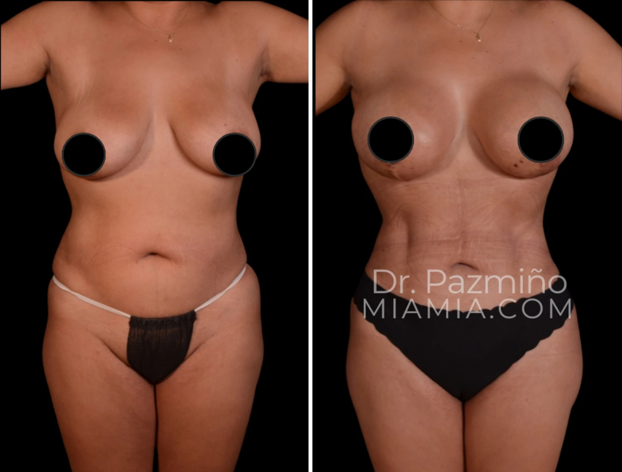 miamiaes (78)