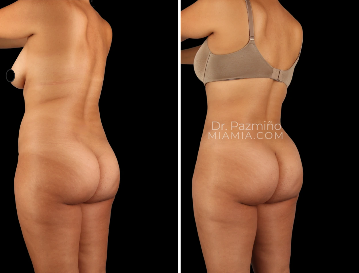 miamiaesthetic (60)